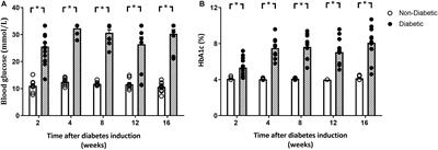 Defining the Progression of Diabetic Cardiomyopathy in a Mouse Model of Type 1 Diabetes